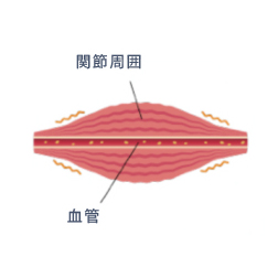 ストレスや負担による炎症発生