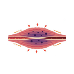 炎症による痛みの出現