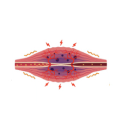 修復反応による血管の増加
