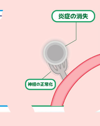 炎症を鎮め、神経と血流を整える
